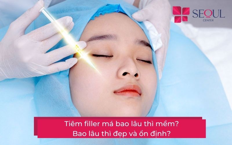 Tiêm filler má bao lâu thì mềm? Bao lâu thì đẹp và ổn định?