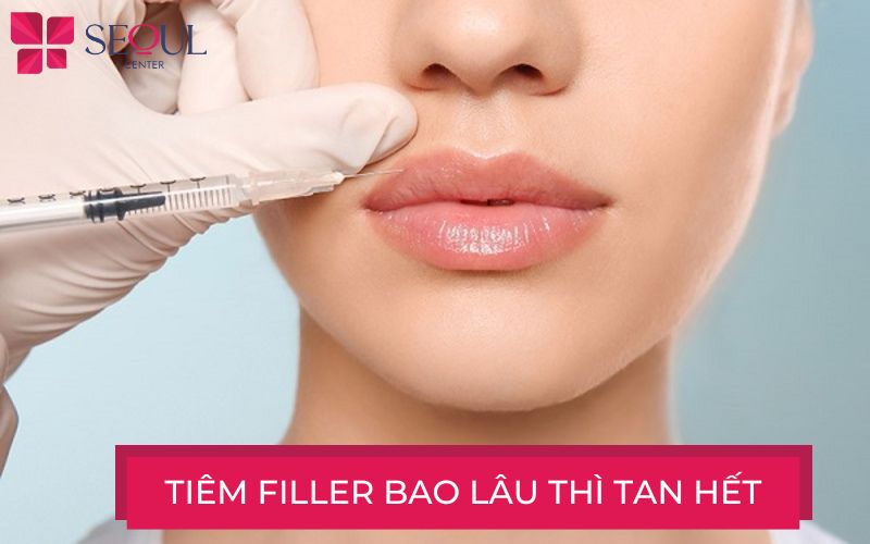 Tiêm filler thì bao lâu tan hết? Filler có tự tan không?