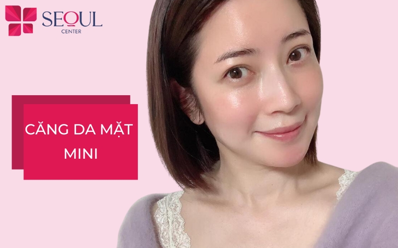 Căng da mặt mini là gì? Hiệu quả ra sao? Giá bao nhiêu?