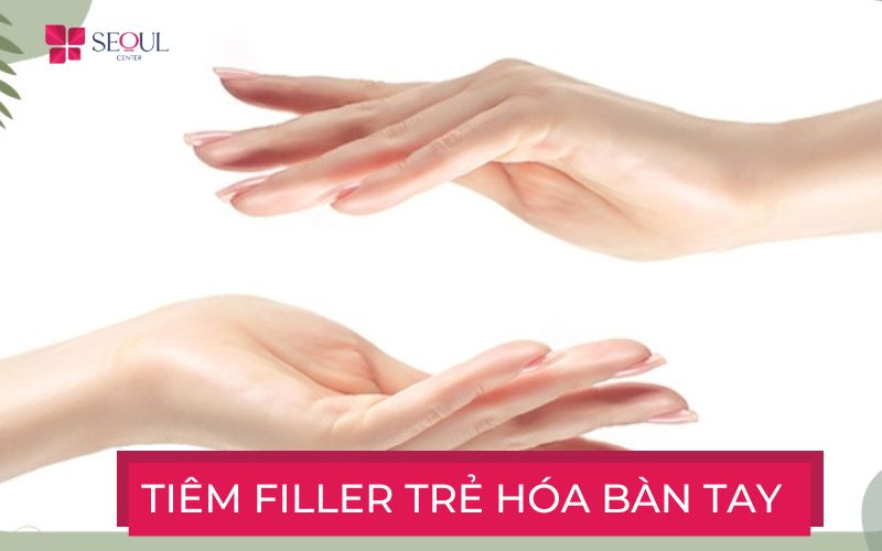 Tiêm filler tay - Giải pháp trẻ hóa đôi tay bạn nên thử