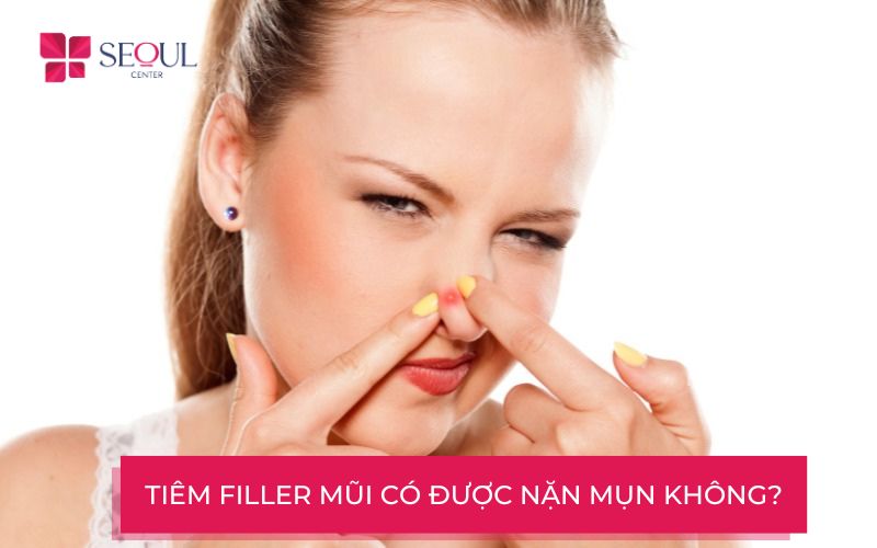 TIêm filler mũi có được nặn mụn không? Vì sao?