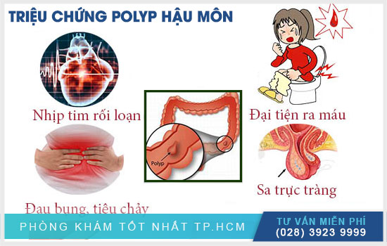 dau-hieu-nhan-biet-benh-polyp-hau-mon.jpg