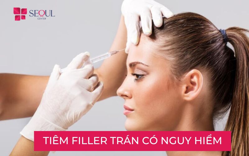 Tiêm filler trán là gì? Cấu tạo ra sao? Ưu và nhược điểm