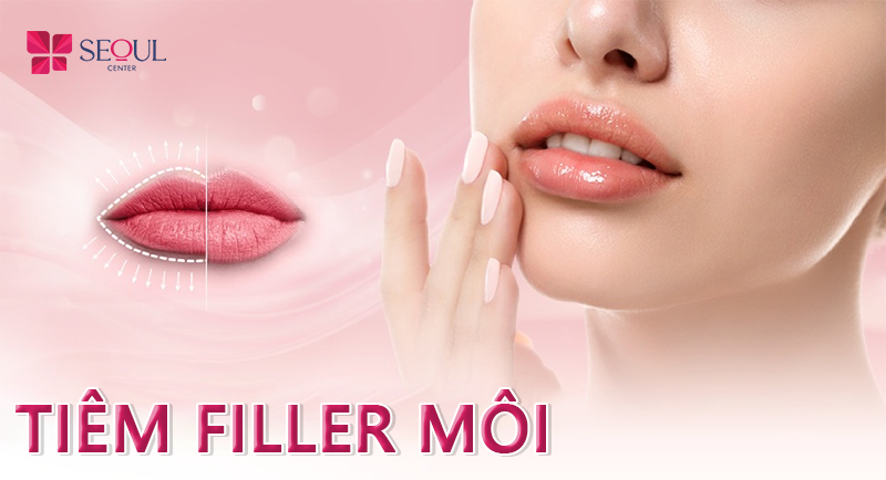 Tiêm filler môi là gì ? Có bao nhiêu dáng môi đẹp hiện nay