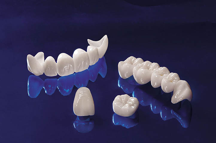 rang-su-ceramill-co-tot-khong-1.jpg