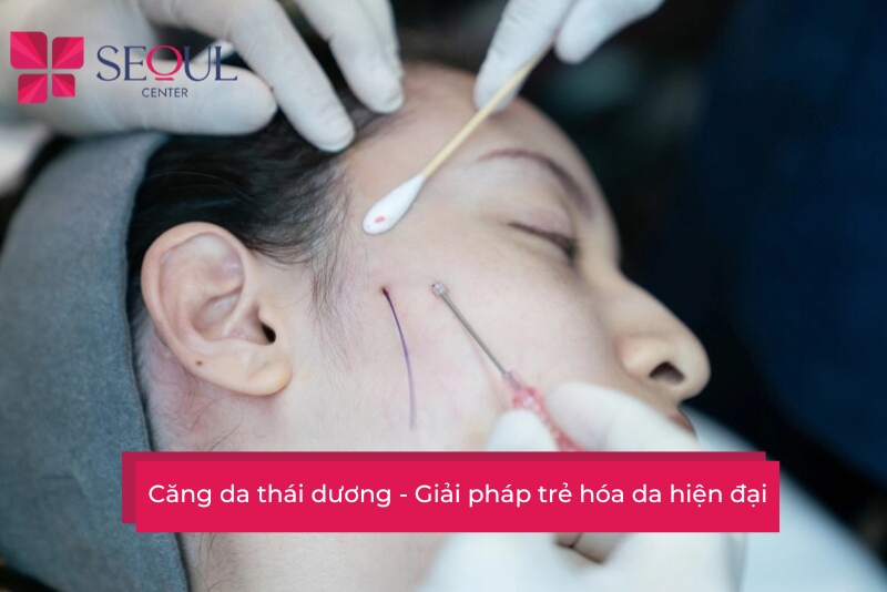 Căng da thái dương: Giải pháp cải thiện độ đàn hồi cho làn da